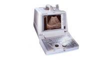 logiq 100 Pro