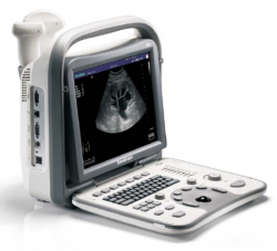 SonoScape A6 Ultrasound Diagnostic System
