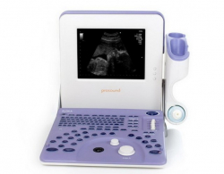 Prosound 2 Ultrasound Machine (Aloka)
