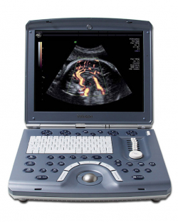 Voluson E GE ultrasound machine
