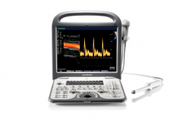 S6Pro Ultrasonic Scanner (SonoScape)
