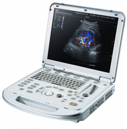 M7 Ultrasonic Scanner (Mindray)
