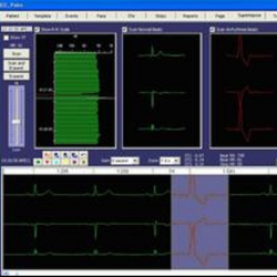 Holter Software HolterCare1 Software ScottCare
