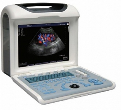 Ultrasound Diagnostic System Explorer 2100 Dixion