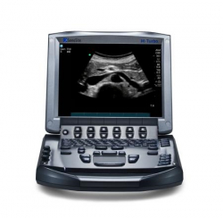 FUJIFILM SonoSite M-Turbo Portable Ultrasound Scanner
