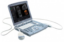 Voluson i Ultrasound Scanner (GE Healthcare)